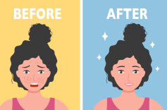 00后长了“老年斑”？！ 专家：做好防晒措施是防范关键