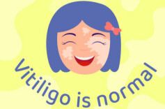 冯小刚白癜风被传治愈，是真的吗？ 皮肤科专家：治愈率高但易复发 长期规范治疗是关键