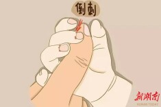 倒刺虽小，仍要注意！这些处理与预防方法学起来！