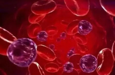 高发于年轻女性！红斑狼疮或有遗传因素，一图科普