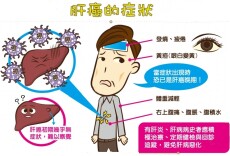 吴孟达、赵英俊皆因肝癌去世  肝癌发现即晚期？专家：学会防护才能抗“肝”扰