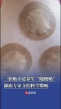 入伏！三伏贴不是养生“随便贴”，湖南专家支招科学敷贴