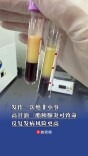 发作一次绝非小事！高甘油三酯胰腺炎可致命，反复发病风险更高