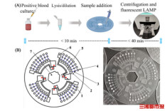 医校联合研发“白菜价”芯片，50分钟锁定血流感染元凶
