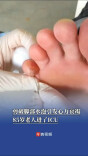 剪破脚部水泡引发心力衰竭，85岁老人进了ICU