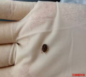 蜱虫钻进1岁幼儿头皮！专家：天气回暖警惕毒虫出没