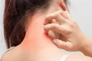 皮肤经常痒，可能是肾不好的信号！