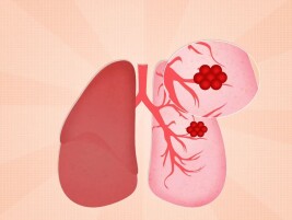 想要远离肿瘤，预防很重要！97岁院士公开六条防癌养生秘诀，最后一条太多人忽略了