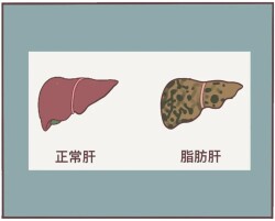 不胖≠远离脂肪肝，这些诱因要警惕
