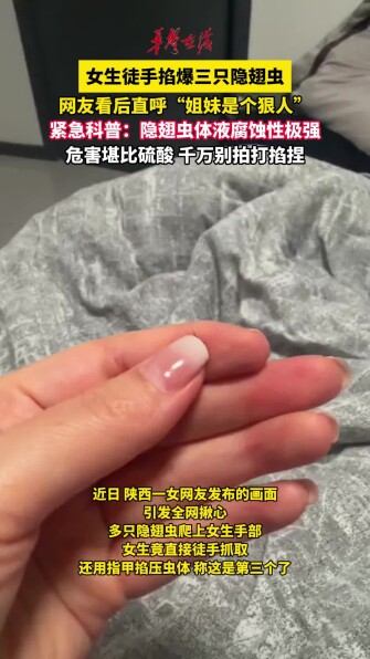 女生徒手掐爆三只隐翅虫 网友紧急科普：落在身上千万别拍