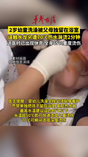 2岁幼童洗澡被独留浴室遭热水淋烫2分钟