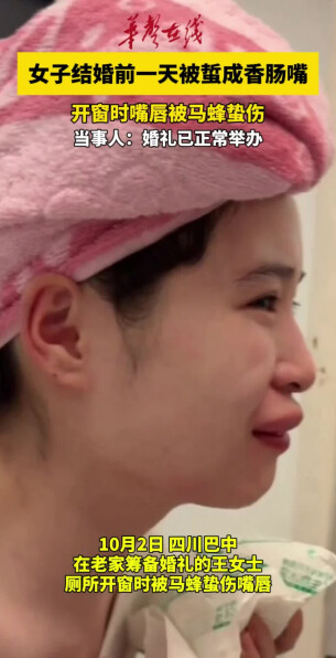 结婚前一天，新娘开窗被马蜂蜇成“香肠嘴”