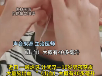 男孩徒手拔烂牙致脑出血偏瘫 医生：换牙期蛀牙千万别自行拔除