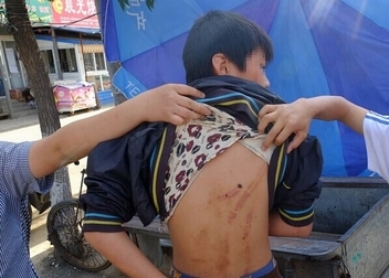 3男子群殴少年 青少年暴力何时休