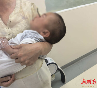 钢筋直抵视神经，南华附二医院眼科精准手术为1岁幼童保住光明