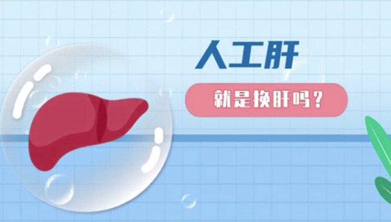 “人工肝”不等于“肝移植” 家有肝病患者看过来