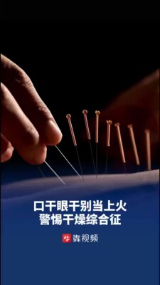 口干眼干别只当“上火”，可能是“干燥综合征”