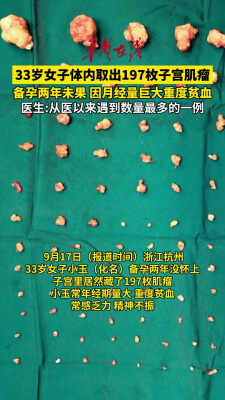 33岁女子体内取出197枚子宫肌瘤