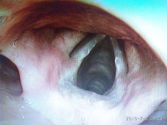 世界杯倒计时 湖南嘶哑失声门诊人数激增
