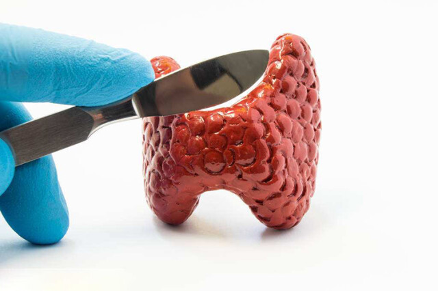 如何避免肿瘤治疗的误区？肿瘤专家告诉你！