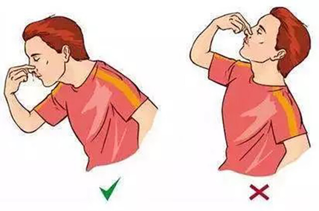 宝宝流鼻血了 是该举手  仰头还是塞棉球？