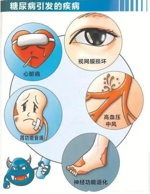 警惕！糖尿病也可引发癌症……