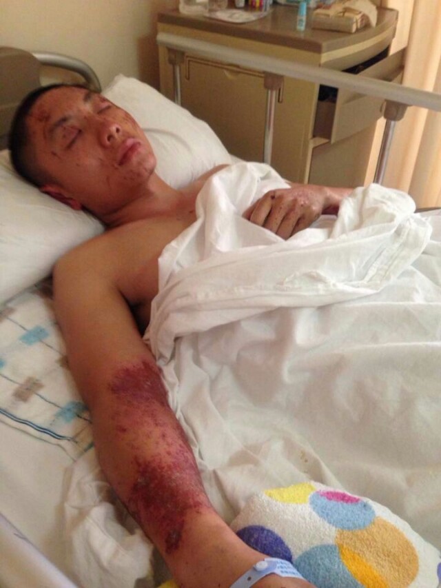 天津爆炸事故中湖南籍受伤消防员廖健丞我现在好多了