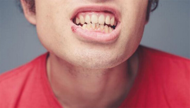 男人身上长了"肾虚纹"是不是肾虚到不可救药的地步了?