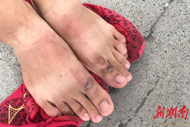 肖黔介绍,经过前期体能,跑板感觉训练,中期跑板运动技能训练以及