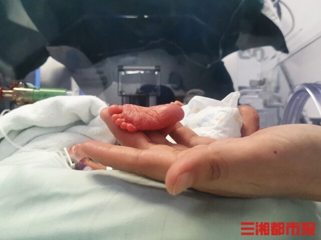 70多天精心救治提前13周降临的巴掌宝宝跑赢死神