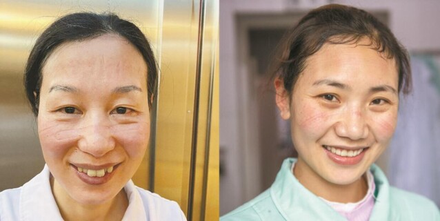 这些痕迹，刻在你脸上，痛在我心里